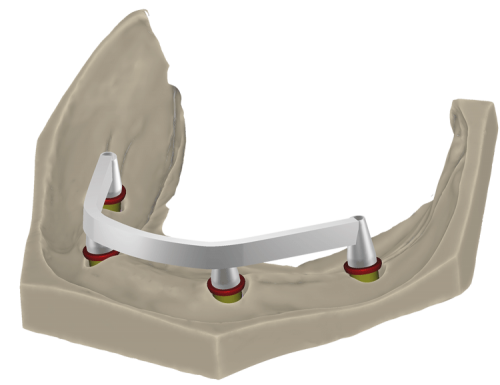 Exocad – Teeth